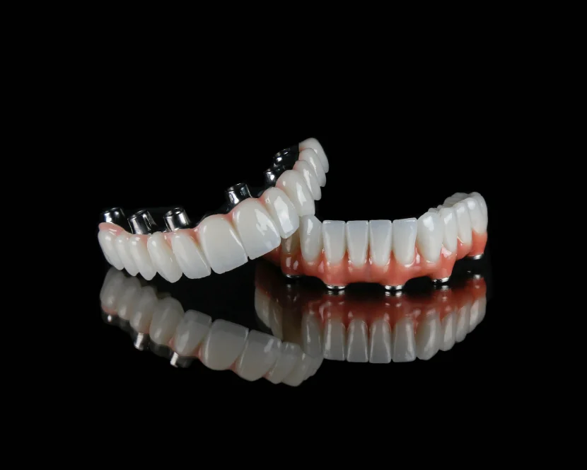 Full-arch case