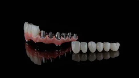 Provisional PMMA