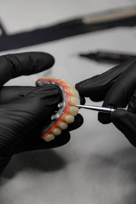 CBCT overlay